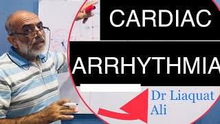 Cardiac Arrhythmia and Types  Urdu amp Hindi  Dr Liaquat Ali Mehr [upl. by Gastineau]