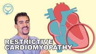 Restrictive Cardiomyopathy RCM for Nursing l NCLEX [upl. by Herahab]