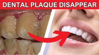 Crush Dental Plaque Naturally The Secret Weapon Against Tartar Revealed [upl. by Leumek]