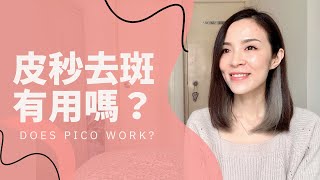 Pico皮秒去斑有效嗎？真實分享8個月效果～ [upl. by Terrie]