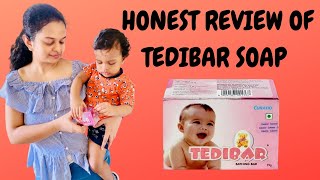 MUST WATCH TEDIBAR soap Honest review TAMIL  Baby fairness soap   Pros and Cons of soap [upl. by Trimble]