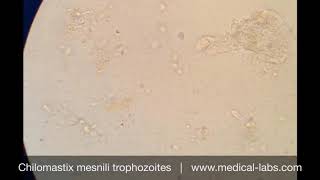 Chilomastix mesnili Trophozoites Lab 4 صيدلة ثانية  طفيليات عملي [upl. by Ecinaej]