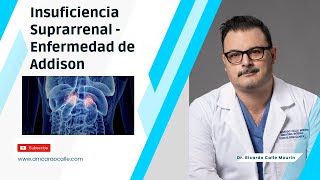 Insuficiencia Suprarrenal  Enfermedad de Addison Síntomas y Signos [upl. by Lotson]