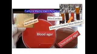 Culture media the simplest way of identification  Blood MacConkey  Chocolate RCM Nurient agar [upl. by Arly]