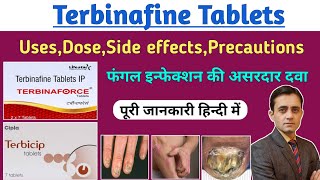 Terbinafine tablets ip 250 mg  Terbinaforce tablet uses dose side effects  फंगल इन्फेक्शन की दवा [upl. by Vitale]