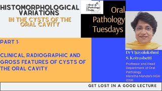 Variations in Cysts of the Oral Cavity part 1 Oral Pathology 360 Fundamantals [upl. by Reynold310]