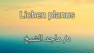 Lichen planus by Dr Maged El Sheikh [upl. by Sefton]