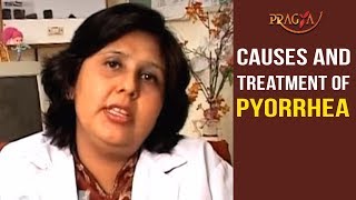 Watch Causes and Treatment of Pyorrhea [upl. by Adorne962]