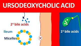 Ursodeoxycholic acid udca for biliary cirrhosis and gallstones [upl. by Phaidra]