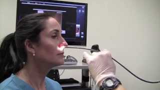 Esophagoscopy Without Sedation TransNasal Esophagoscopy Esophagus Exam Endoscopy [upl. by Boice]