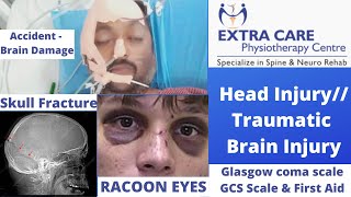 Head Injury Symptoms in hindi Brain injury Types First Aid  GCS Scale  Traumatic Brain Injury TBI [upl. by Albarran312]