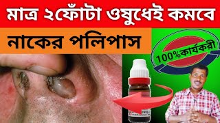 নাকের পলিপাসের শীর্য হোমিও ঔষধ l Nasal polyps homeopathic medicine l Nasal polyps homeopathic l [upl. by Alita]