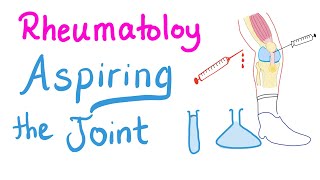 RheumatologyJoint Fluid Analysis Physiology [upl. by Renelle]