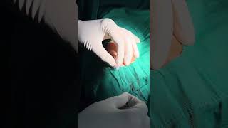 How To Puncture The Radial Artery  Counter Puncture Technique [upl. by Airdnassac]