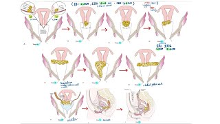 cervical cancer staging [upl. by Gathard]