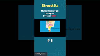 Sinusitis infeksi gigi 5 irigasinasal safahhhealth sinusitis [upl. by Cirnek388]