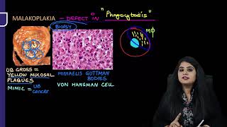 Renal Pathology Rapid Revision For FMGE amp NEET PG By Dr Preeti Sharma [upl. by Lowry]