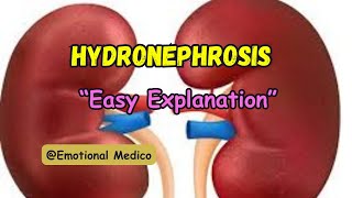 Hydronephrosis  Renal pathology mediumrobbins emotionalmedico [upl. by Qerat]