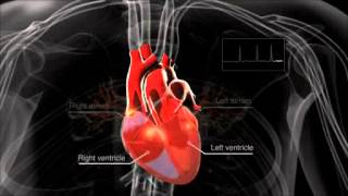 What is atrial fibrillation [upl. by Noram]