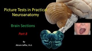 Picture Test in Neuroanatomy Brain Sections 8 [upl. by Kcirdehs]