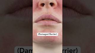 Skin Barrier Strengthening  How to Guide [upl. by Eceirtal919]