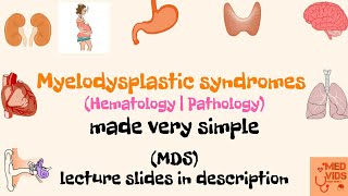 Myelodysplastic syndromes  MDS  Pathology  Med Vids made simple [upl. by Yttik]