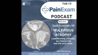 Multifidus Atrophy Multifidus Stimulation Peripheral Nerve Stimulation amp Leukocyte Rich PRP [upl. by Edelman]