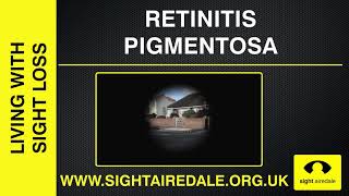 Simulation of Retinitis Pigmentosa [upl. by Eiduam]