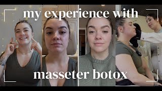 MY EXPERIENCE WITH MASSETER BOTOX for my TMJD  come get botox with me  a chat about skincare [upl. by Agrippina]