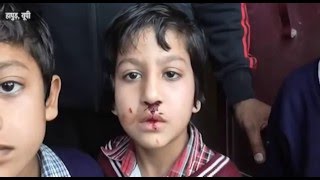 Shocking  Nursery Student Brutally Beaten by School Manager in UP [upl. by Agni]