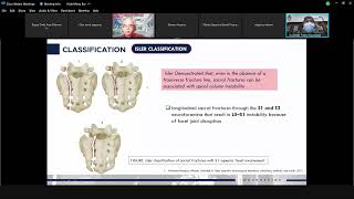 Jumat Ilmiah  Management of Sacrococcygeal Fracture [upl. by Nivets373]