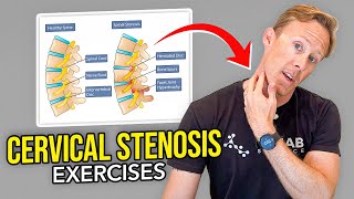 5 Exercises for Cervical Stenosis Arm Nerve Pain [upl. by Inness]