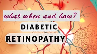 This will change your perspective about DIABETIC RETINOPATHY [upl. by Sidwohl]