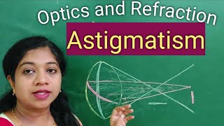 Astigmatism CausesTypes With the rule AstigmatismSimplecompoundMixed SymptomsTreatment [upl. by Annal]