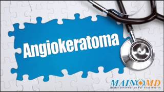 Angiokeratoma ¦ Treatment and Symptoms [upl. by Nelly]