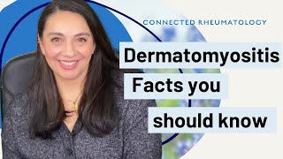 Dermatomyositis Facts your Rheumatologist wants you to know [upl. by Anyal]