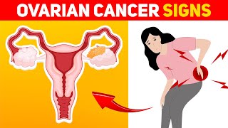 9 Warning Signs of Ovarian Cancer Every Woman Should Know [upl. by Kopple]