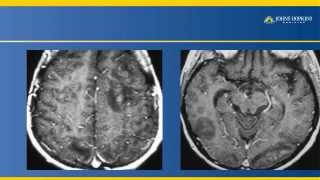 eRadiology Learning  Neuroradiology Pearls and Pitfalls 4 of 4 [upl. by Sikata561]