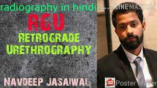 Retrograde urethrography RGU  radiography in hindi [upl. by Mano]