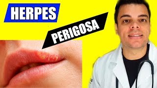 Herpes simples  Um perigo silencioso  Renato Almeida [upl. by Satsok993]