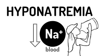 HYPONATREMIA made easy [upl. by Ashjian801]