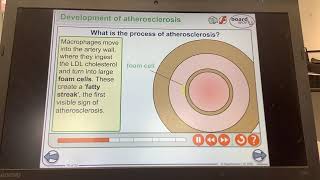 KS4GCSEBIOLOGYOrganisationThe process of atherosclerosis [upl. by Gresham]