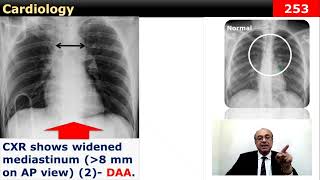 internalmedicine cme usmle محاضراتباطنة ecg كورساتباطنة clinical clinical medicine [upl. by Edya]