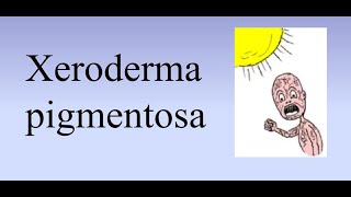 Xeroderma pigmentosum XP [upl. by Sugden]