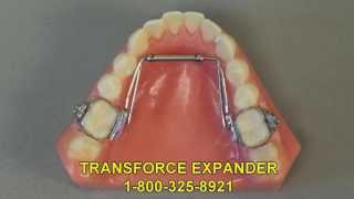 TransForce Expander Appliance  Arch Expander Appliance [upl. by Riehl]