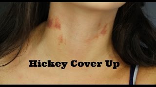 How To Cover up hickeys [upl. by Granville]