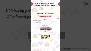 Types of Grids in Radiology [upl. by Gwendolen]