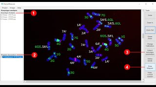 Karyotype analysis using KaryoMeasure [upl. by Corrina]