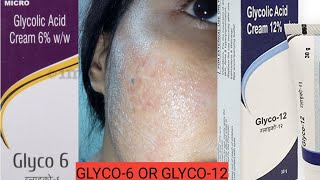 Glycolic Acid Cream 6 vs Glycolic Acid 12  How to Use Glycolic acid cream [upl. by Sum]