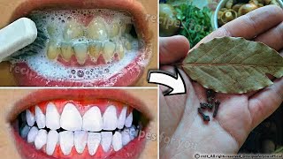 Secret that Dentists dont want you to know Remove Tartar and Teeth Whitening in just 2 minutes [upl. by Niamrahc804]